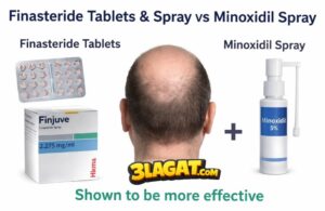 مراجعة فينجوفي سبراي Finjuve: فيناسترايد لعلاج الصلع الوراثي! اقراص أم سبراي؟ وهل يغني عن المينوكسيديل؟